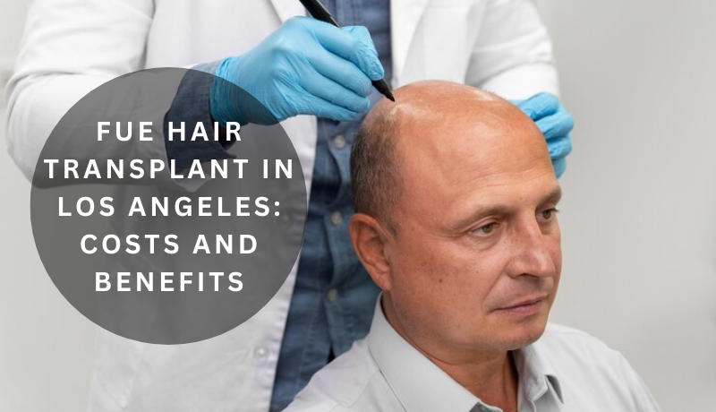 fue hair transplant Los Angeles